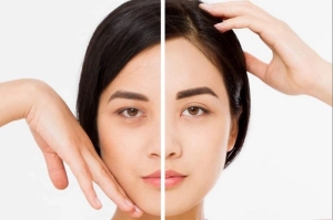 Nâng cung chân mày